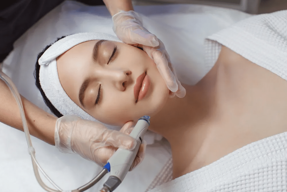 Acne Laser Treatment Lakeland FL