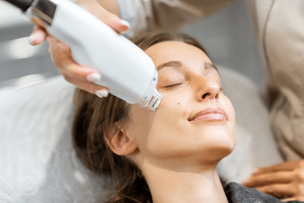 Laser Acne care Lakeland FL