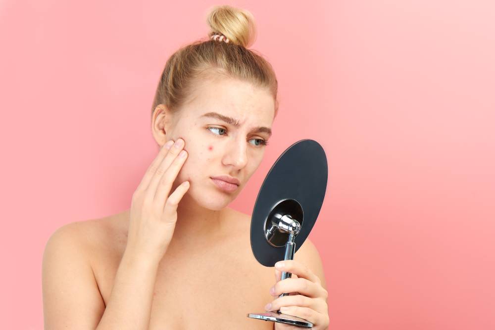 Woman frowns, gazing at her acne scars in a handheld mirror